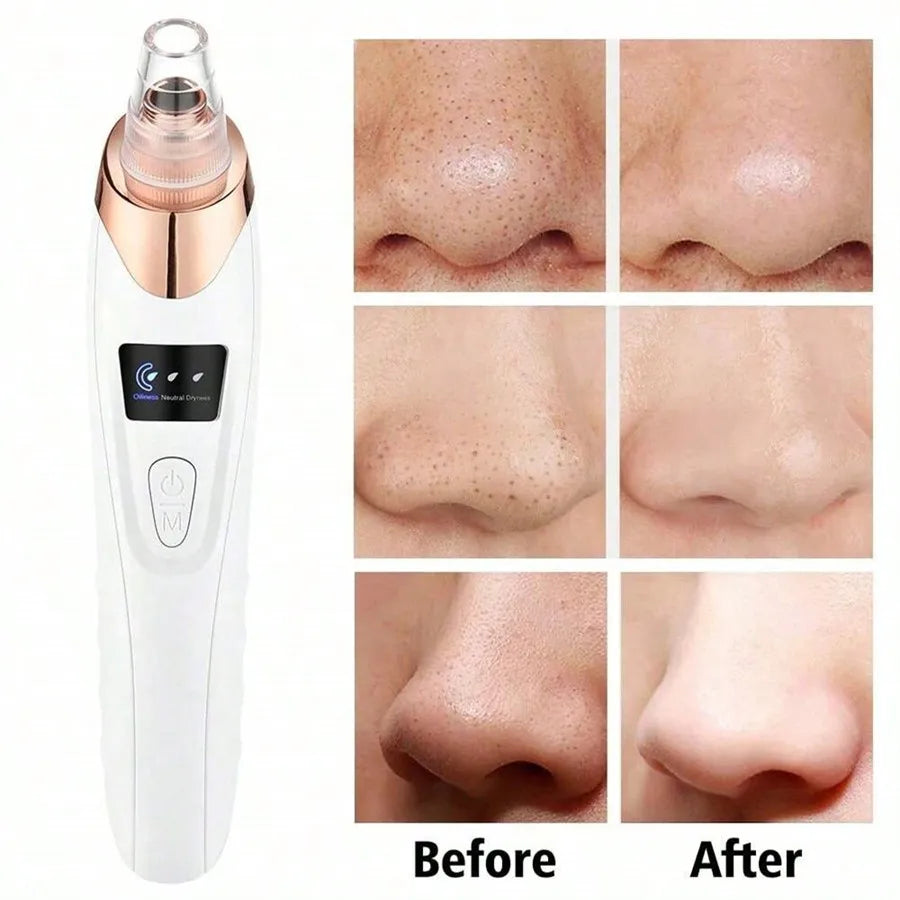 Electric Blackhead Remover Vacuum Cleaner Black Spots Removal Facial Deep Cleansing Pore Cleaner Machine Face Skin Care Tools