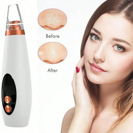 Electric Vacuum Suction Blackhead Remover Facial Pore Cleaner Comedone Spot Acne Pimple Blackhead Extractor USB Rechargeable