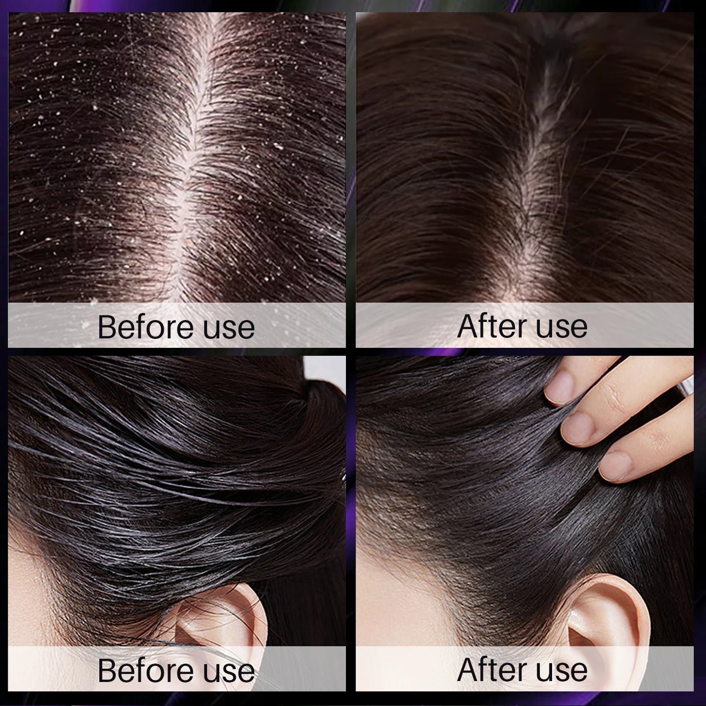 Hair Shampoo For Fast Hair Growth Rosemary Onion Hair Regrowth Shampoo Anti Hair Loss Effective Within 7 Day Hair Growth Product