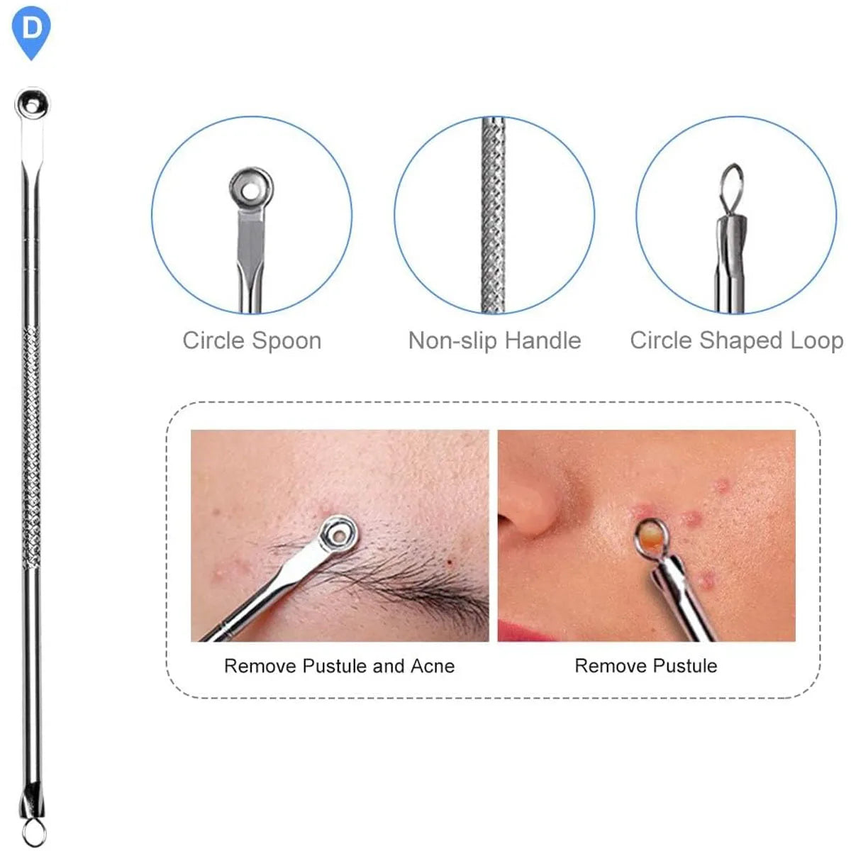 4PCS Acne Blackhead Comedone Black Spot Pimple Blemish Remover Skin Care Women Beauty Acne Treatment Pore Cleanser Needle Hook