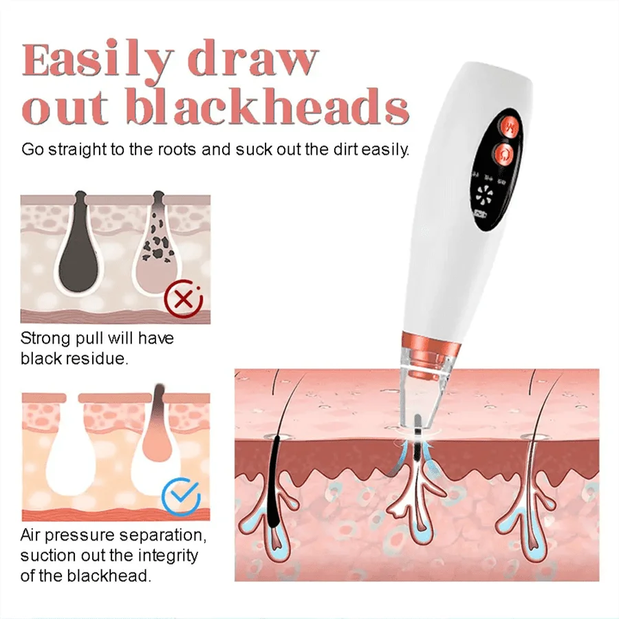 Electric Vacuum Suction Blackhead Remover Facial Pore Cleaner Comedone Spot Acne Pimple Blackhead Extractor USB Rechargeable