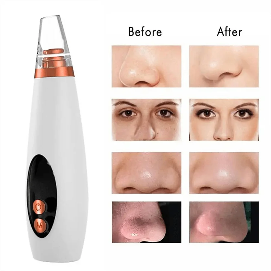 Electric Vacuum Suction Blackhead Remover Facial Pore Cleaner Comedone Spot Acne Pimple Blackhead Extractor USB Rechargeable