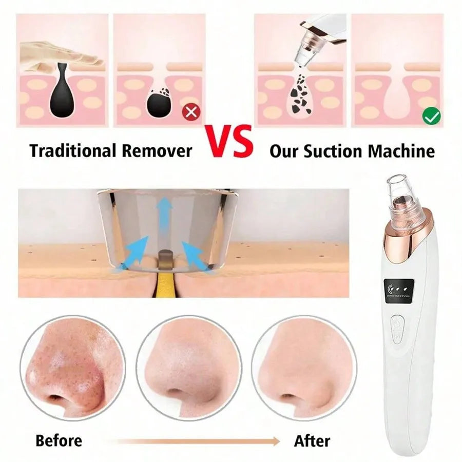 Electric Blackhead Remover Vacuum Cleaner Black Spots Removal Facial Deep Cleansing Pore Cleaner Machine Face Skin Care Tools