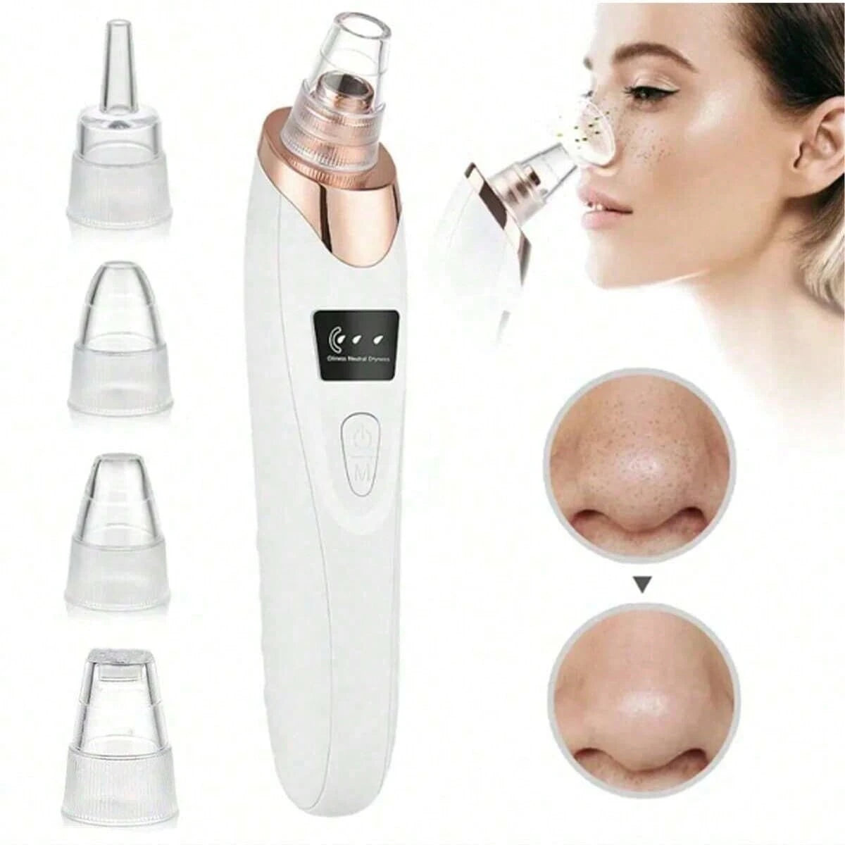 Electric Vacuum Suction Blackhead Remover Facial Pore Cleaner Comedone Spot Acne Pimple Blackhead Extractor USB Rechargeable