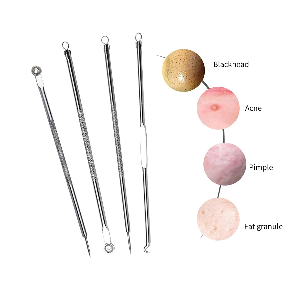 4PCS Acne Blackhead Comedone Black Spot Pimple Blemish Remover Skin Care Women Beauty Acne Treatment Pore Cleanser Needle Hook